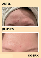 COSRX – Esencia a base de mucina de caracol