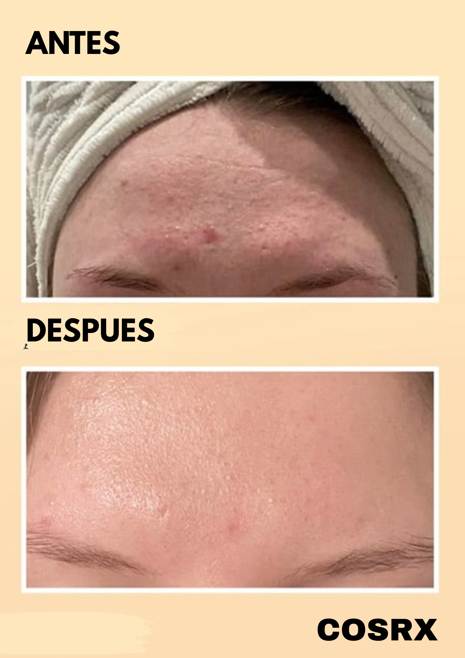 COSRX – Esencia a base de mucina de caracol